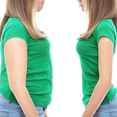 Before and after photos of a girl's weight loss journey