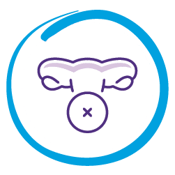Hysterectomy procedure
